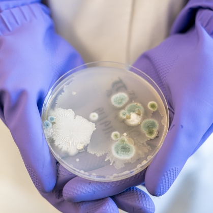 mold growing inside a petri dish held by gloved hands